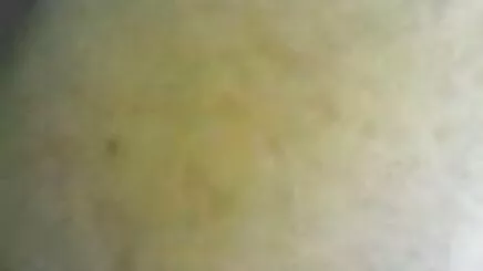 Kullandıktan doktor lezbiyen porno sonra yüz için yiyecek alın